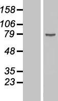 DDX18 Human Over-expression Lysates NM_006773