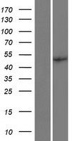 EIF2B3 Human Over-expression Lysates NM_001166588