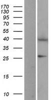 EIF2B2 Human Over-expression Lysates NM_014239