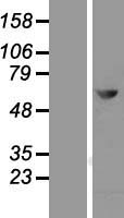 MTMR2 Human Over-expression Lysates NM_201281