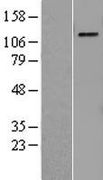 PRPF4B Human Over-expression Lysates NM_003913