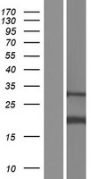 AP1S2 Human Over-expression Lysates NM_003916