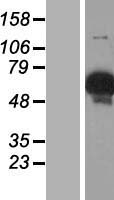 Glycogenin 2 (GYG2) Human Over-expression Lysates NM_001079855