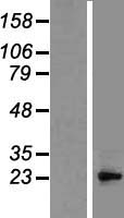 BCL10 Human Over-expression Lysates NM_003921