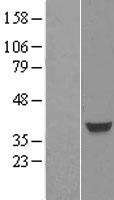 ls008928 foxh1 human over expression lysates nm 003923 wb testing 1