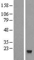 CXX1 (FAM127A) Human Over-expression Lysates NM_001078171