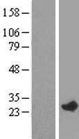 RAB7L1 (RAB29) Human Over-expression Lysates NM_001135662