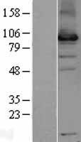 USP13 Human Over-expression Lysates NM_003940