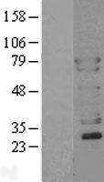 N WASP (WASL) Human Over-expression Lysates NM_003941