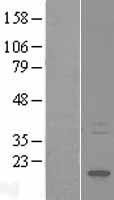 ls008988 hspb3 human over expression lysates nm 006308 wb testing 1