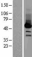 Selenium Binding Protein 1 (SELENBP1) Human Over-expression Lysates NM_003944