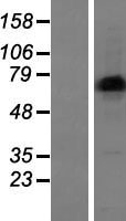 LIMD1 Human Over-expression Lysates NM_014240