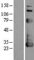 Apoptosis repressor with CARD (NOL3) Human Over-expression Lysates NM_003946