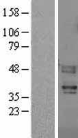 Proteinase Activated Receptor 4 (F2RL3) Human Over-expression Lysates NM_003950