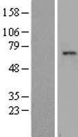 TAF1B Human Over-expression Lysates NM_005680