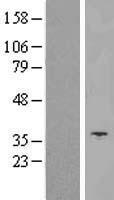 SLC25A14 Human Over-expression Lysates NM_003951