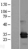 MPZL (MPZL1) Human Over-expression Lysates NM_003953