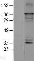 NFkB Inducing Kinase NIK (MAP3K14) Human Over-expression Lysates NM_003954