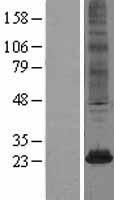 NAT8 Human Over-expression Lysates NM_003960
