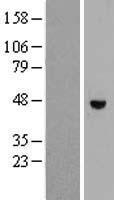 ls009028 rhbdl1 human over expression lysates nm 003961 wb testing 1