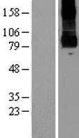 PKD2L1 Human Over-expression Lysates NM_016112