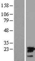 UBE2M Human Over-expression Lysates NM_003969