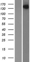 JLP (SPAG9) Human Over-expression Lysates NM_003971