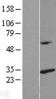 RPL14 Human Over-expression Lysates NM_001034996