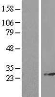 RPL14 Human Over-expression Lysates NM_003973