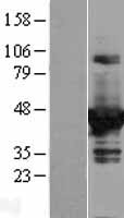 ls009046 dok2 human over expression lysates nm 003974 wb testing 1