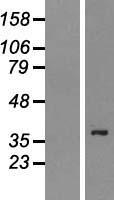 PSTPIP2 Human Over-expression Lysates NM_024430