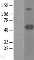 PSTPIP1 Human Over-expression Lysates NM_003978