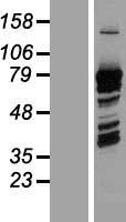 PRC1 Human Over-expression Lysates NM_003981