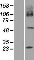 SLC7A7 Human Over-expression Lysates NM_001126105