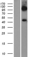 SLC7A6 Human Over-expression Lysates NM_001076785