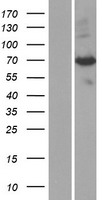 PAPSS1 Human Over-expression Lysates NM_005443