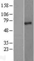 PIAS2 Human Over-expression Lysates NM_004671