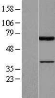 PIAS2 Human Over-expression Lysates NM_173206