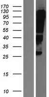 Claudin 12 (CLDN12) Human Over-expression Lysates NM_012129