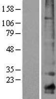 Claudin 10 (CLDN10) Human Over-expression Lysates NM_006984