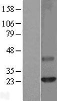 Claudin 6 (CLDN6) Human Over-expression Lysates NM_021195