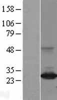 ARHI (DIRAS3) Human Over-expression Lysates NM_004675