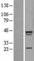 LDB2 Human Over-expression Lysates NM_001290