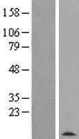 TMSB4Y Human Over-expression Lysates NM_004202