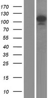 SART1 Human Over-expression Lysates NM_005146
