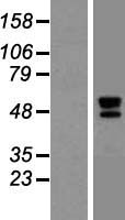 TID1 (DNAJA3) Human Over-expression Lysates NM_005147
