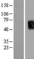 Tpit (TBX19) Human Over-expression Lysates NM_005149