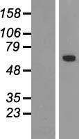 TBX18 Human Over-expression Lysates NM_001080508