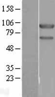 USP10 Human Over-expression Lysates NM_005153