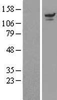 USP8 Human Over-expression Lysates NM_001128610